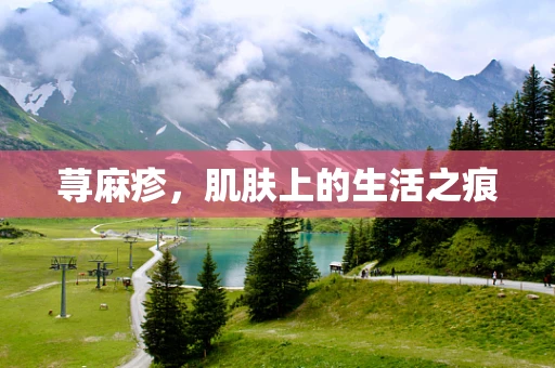 荨麻疹，肌肤上的生活之痕